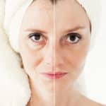 Younger Skin Apperance