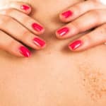 What Do Fraxel Lasers Treat