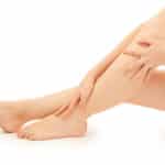 Varicose Veins