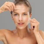 chemical peels