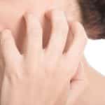 Summer Skin Rashes