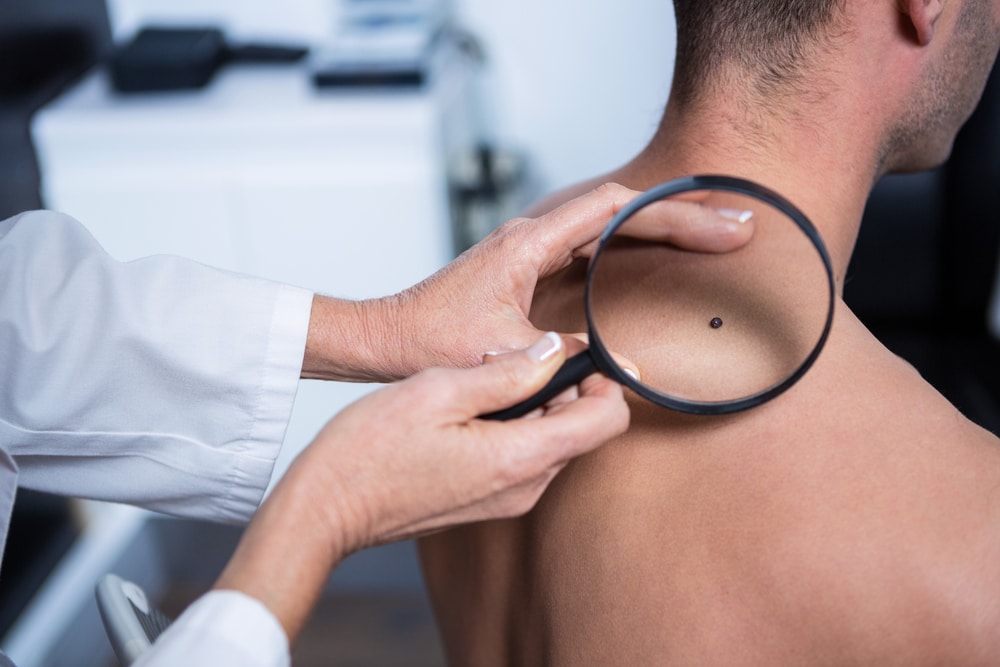 Mohs Treatment Morris Plains NJ