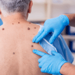 Old man visiting young male doctor dermatologist
