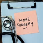 Mohs surgery