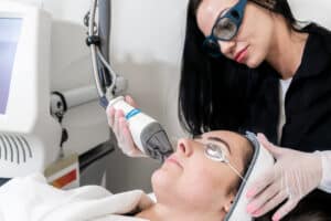 Fraxel® laser