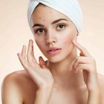 Close-up of a woman at home dealing with an acne problem, highlighting the challenges of managing adult acne and the importance of targeted treatments