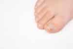 Nail Psoriasis or Nail Fungus? How Dermatologists Tell the Difference