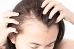 PRP Beyond Hair Loss: How It May Support Scars and Skin Rejuvenation