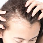 Woman examining thinning hair along her scalp, representing PRP treatment commonly associated with hair restoration.