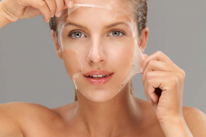 chemical peels