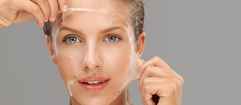 Chemical Peels Short Hills NJ