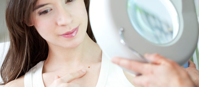 Cysts, Moles & Lipomas Short Hills NJ