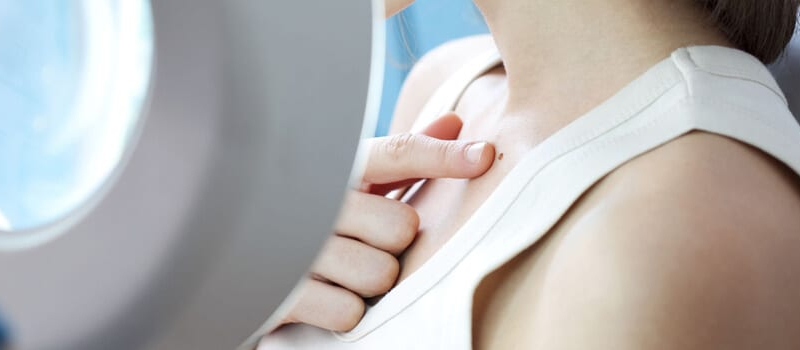 Mohs Surgery Short Hills NJ