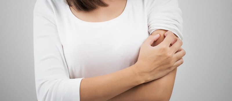 Psoriasis Short Hills NJ